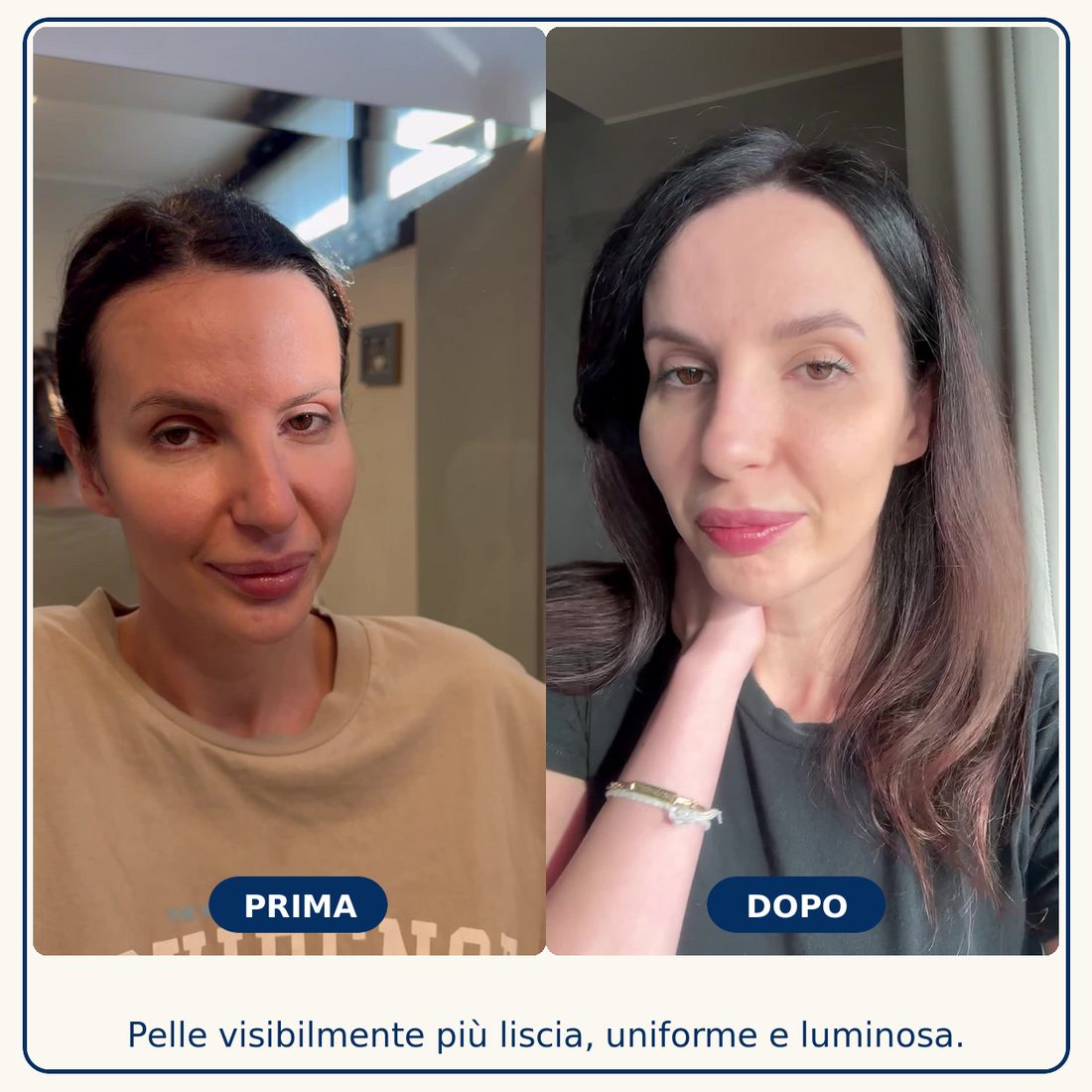 Prima e dopo: Pelle visibilmente più liscia, uniforme e luminosa
