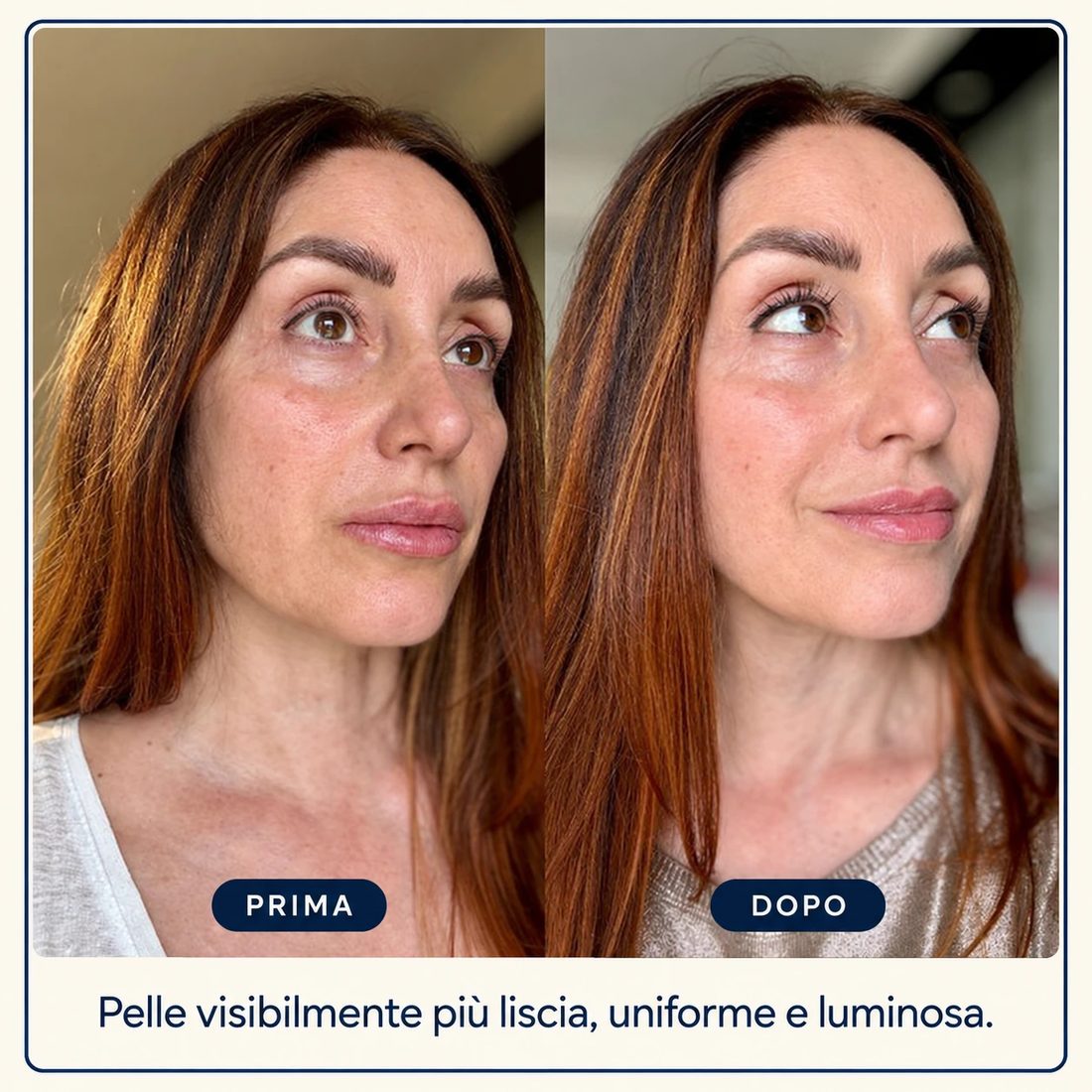 Prima e dopo: Pelle visibilmente più liscia, uniforme e luminosa