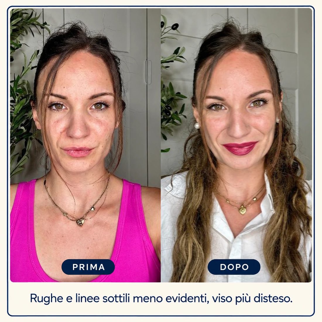Prima e dopo: Rughe e linee sottili meno evidenti, viso più disteso