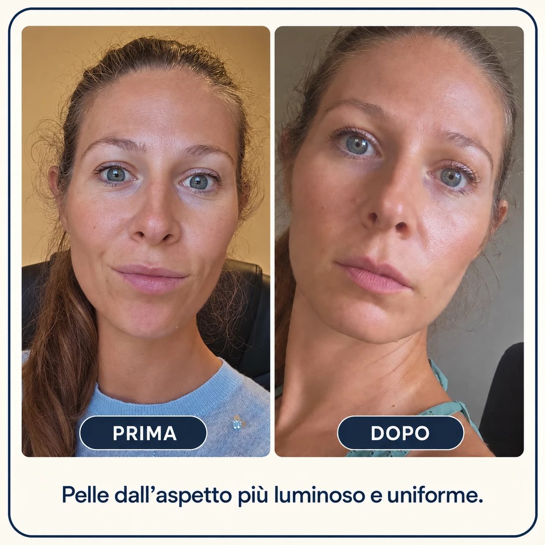 Prima e dopo: Pelle dall'aspetto più luminoso e uniforme