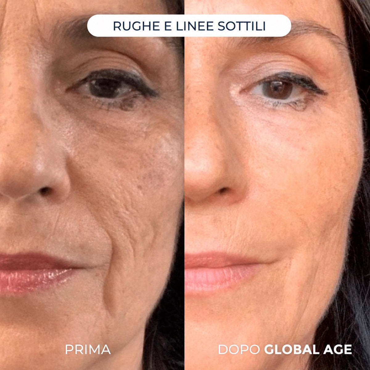 Confronto rughe e linee sottili