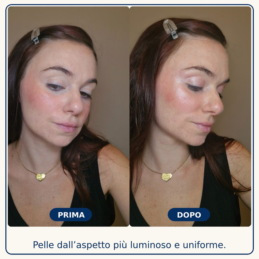 Prima e dopo: Pelle dall'aspetto più luminoso e uniforme