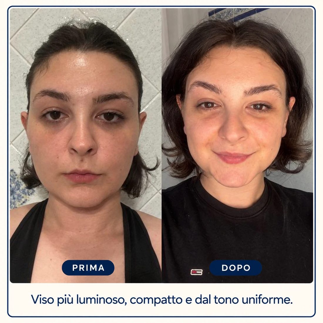 Prima e dopo: Viso più luminoso, compatto e dal tono uniforme
